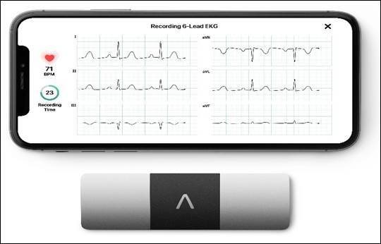 AliveCor’s KardiaMobile 6L